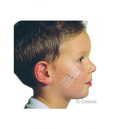 3M STERI STRIP Blendtone 6x75mm natur 50 x 3 Stk